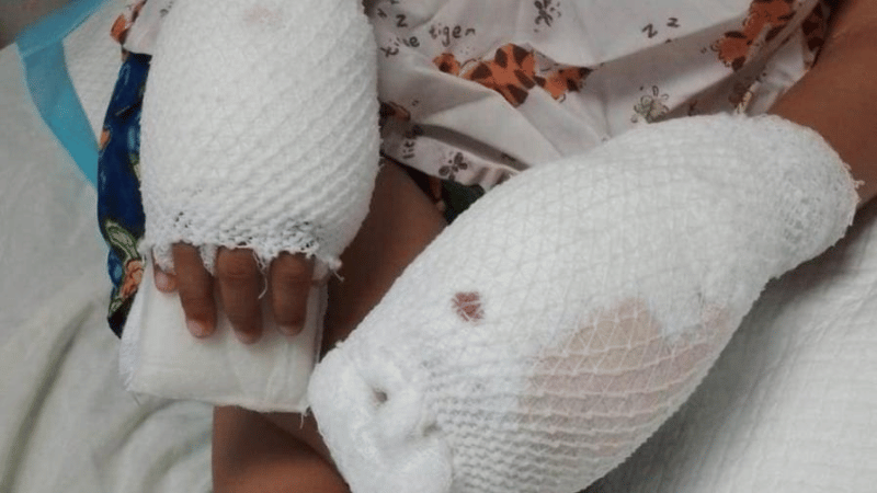 Imputada de Maltrato Infantil Recibe Prisión Preventiva Tras Causar Quemaduras a Su Hijo de Cuatro Años